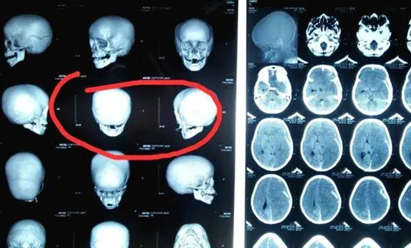 ഏഴു വയസുകാരന്റെ ആരോഗ്യനിലയില്‍ പുരോഗതിയില്ല; തലച്ചോറിന്റെ പ്രവര്‍ത്തനം നിലച്ചു