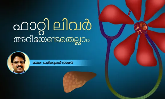 nash, nash liver, nonalcoholic steatohepatitis, steatohepatitis, nash cirrhosis, nash disease, what is nash, alcohol-related liver disease, കരള്‍, കരള്‍ രോഗം, കരള്‍ രോഗങ്ങള്‍, കരള്‍ വീക്കം, കരള്‍ മാറ്റം