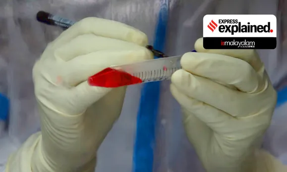coronavirus test, covid 19 test, coronavirus antibody test, coronavirus rapid antigen test, coronavirus rt pcr test, indian express, ie malayalam, ഐഇ മലയാളം