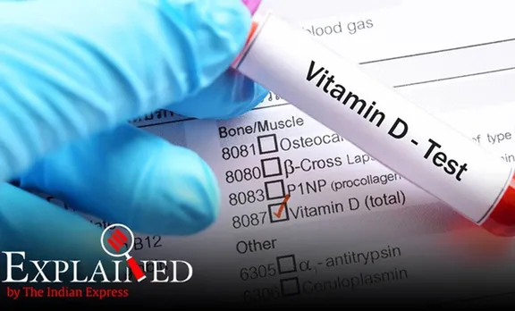 covid patients, vitamin d deficiency, coronavirus patients, coronavirus, endocrine society, express explained
