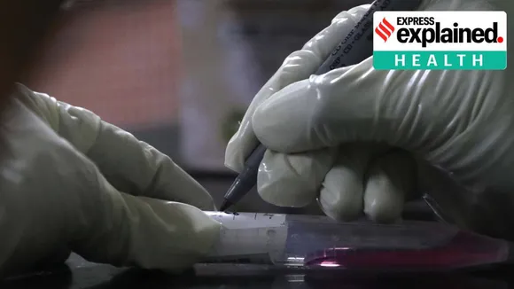 coronavirus test, covid-19 test, Covid testing kit, Covid testing one second, Indian Express, കോവിഡ്, കോവിഡ് പരിശോധനാ ഫലം, കോവിഡ് ഫലം, ie malayalam