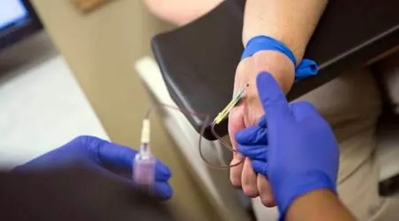 Dialysis, Free Dialysis