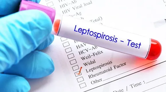 Leptospirosis, Rat fever, Leptospirosis symptoms