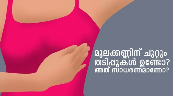 areola, dark areola, bumpy nipples, bumps around the nipples, bumps on the areola, breast health, know your breast, indian express news