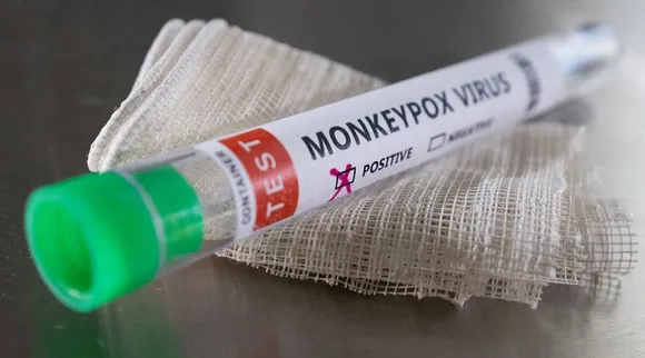 monkeypox, health, ie malayalam