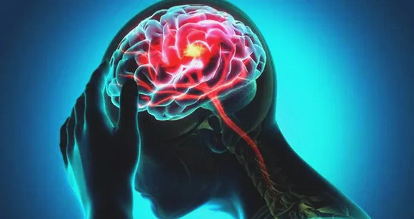 Migraine, headaches, health