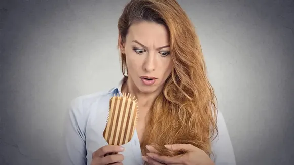 dandruff remedies, itchy scalp remedies, natural remedies for dandruff, natural remedies for itchy scalp