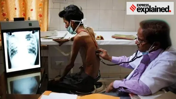 Tuberculosis, TB in India, TB cases, TB cases in India, India TB cases, Tuberculosis treatmenTuberculosis, theme, TB in India, TB cases, TB cases in India, India TB cases, Tuberculosis treatment, World TB Day, Indian express explained, India news, Indian Express, World TB Day,