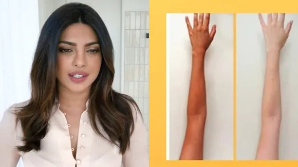 Priyanka Chopra Magical De tan mask