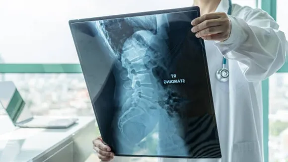 spine