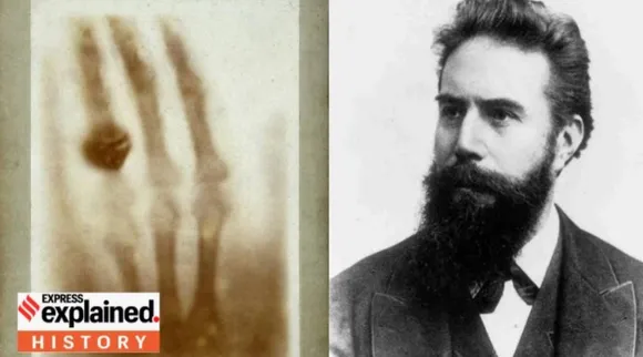 X rays 
