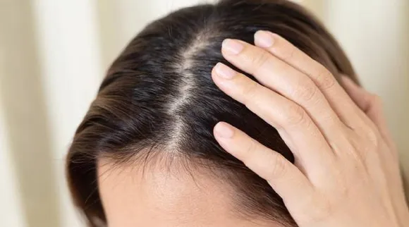 Healthy hair