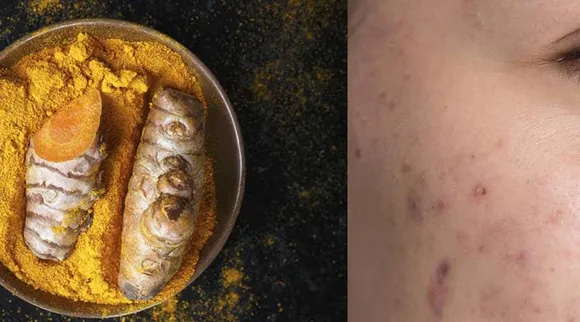 Turmeric