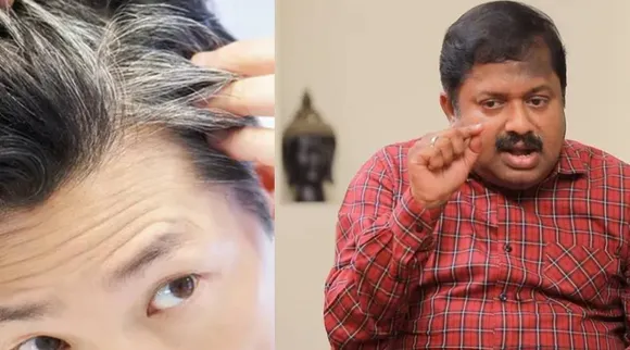 Greyhair issue