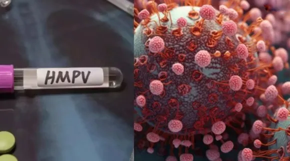 HMPV Virus