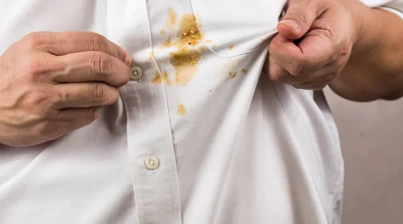 Stains in dress