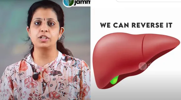 dr deepthi liver