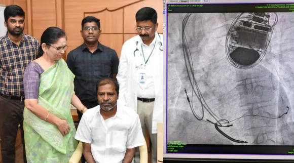 Coimbatore govt hospital doctors save heart disease patient live by Cardiac resynchronization therapy CRT Tamil News