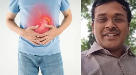 Irritable bowel syndrome
