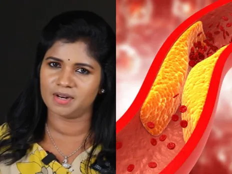 cholesterol