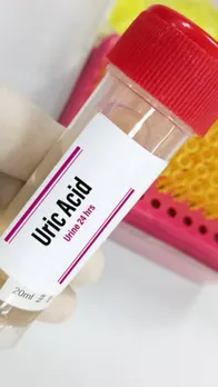 uric acid