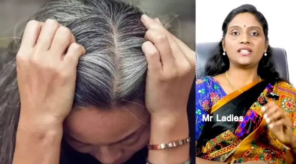 white hair homeremedy
