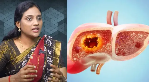 Toxins in liver