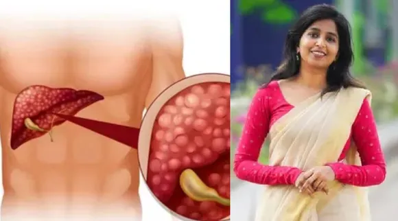 Fatty liver issue