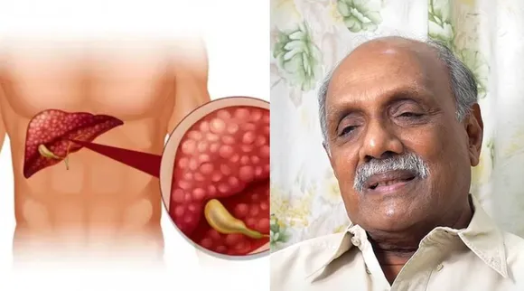 Doctor Chokkalingam
