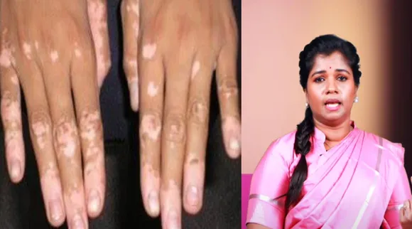 வென்புள்ளி