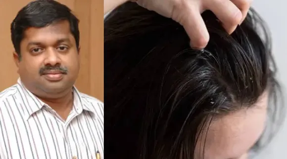 Dandruff remedy