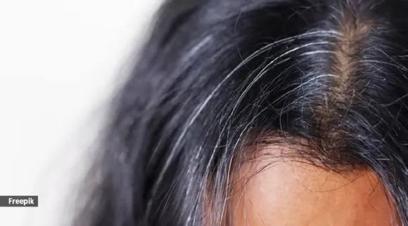 Grey hair myths