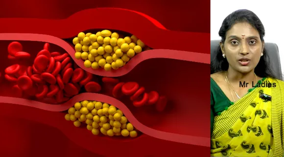  bad fat; Dr. Nithya