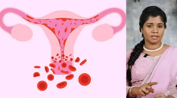  #menstrual #girls