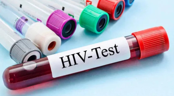  HIV test kits
