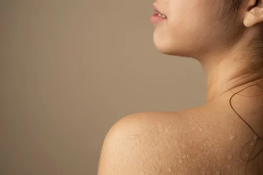 Dark neck 