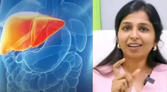 Fatty liver issue