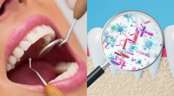 tooth