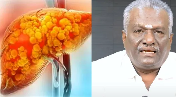 Doctor Subramanian Nachiyappan  