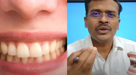Gums and Grow Back?