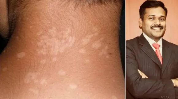 white spots on your s
