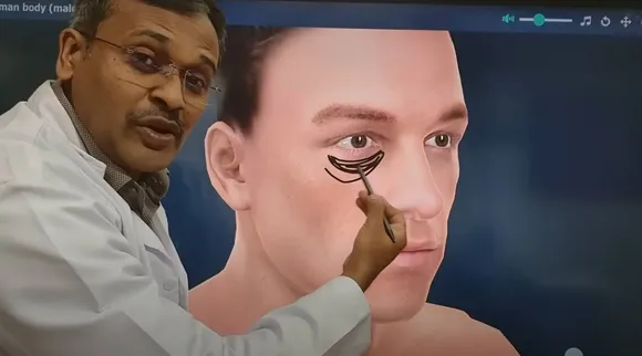 dark circles under eyes