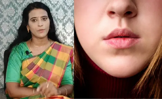 Black lip discolouration