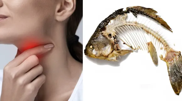 What to do if fish bone stuck
