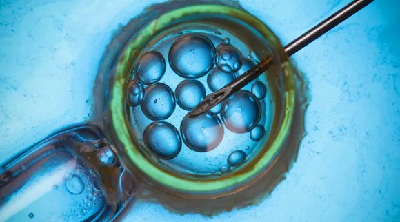 3-parent IVF Technique