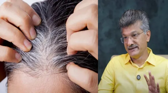 white hair