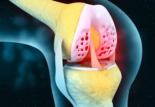 joint pain