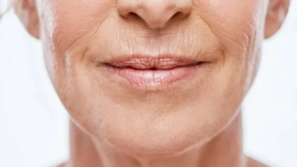 wrinkles