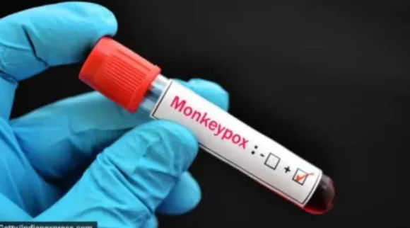 Mpox