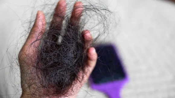 hairfall
